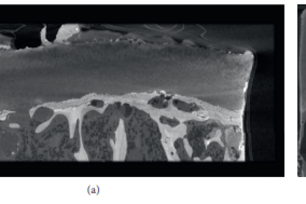 Contrast-Enhanced Micro-CT for Virtual 3D Anatomical Pathology of Biological Tissues: A Literature Review